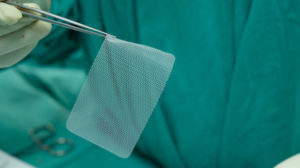 hernia mesh implant lawsuit